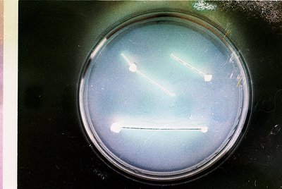 Petri dish showing bacterial streaking for isolation, likely *Staphylococcus* or *Streptococcus* colonies. Three distinct str...