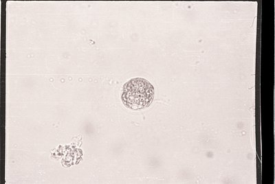 Microscopic view of a single blastocyst-stage embryo (central) with smaller cell clusters, likely from IVF or assisted reprod...