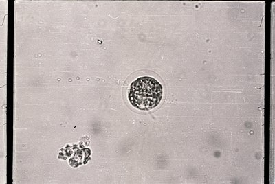 Microscopic view of clustered cells, likely bacteria or fungal spores under high magnification. Circular formation suggests p...