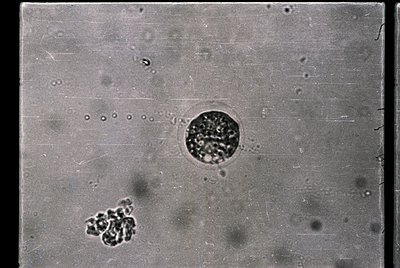 Microscopic view of cellular structures, likely bacteria or protozoa, under a high-magnification lens. The central circular f...