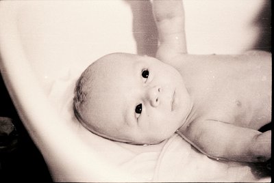 Black-and-white candid of an infant in a bathtub, likely mid-20th century. Soft focus highlights innocence; visible birthmark...