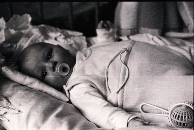Black-and-white photo of an infant with a tracheostomy tube, lying in a hospital crib. Medical equipment like a humidifier is...