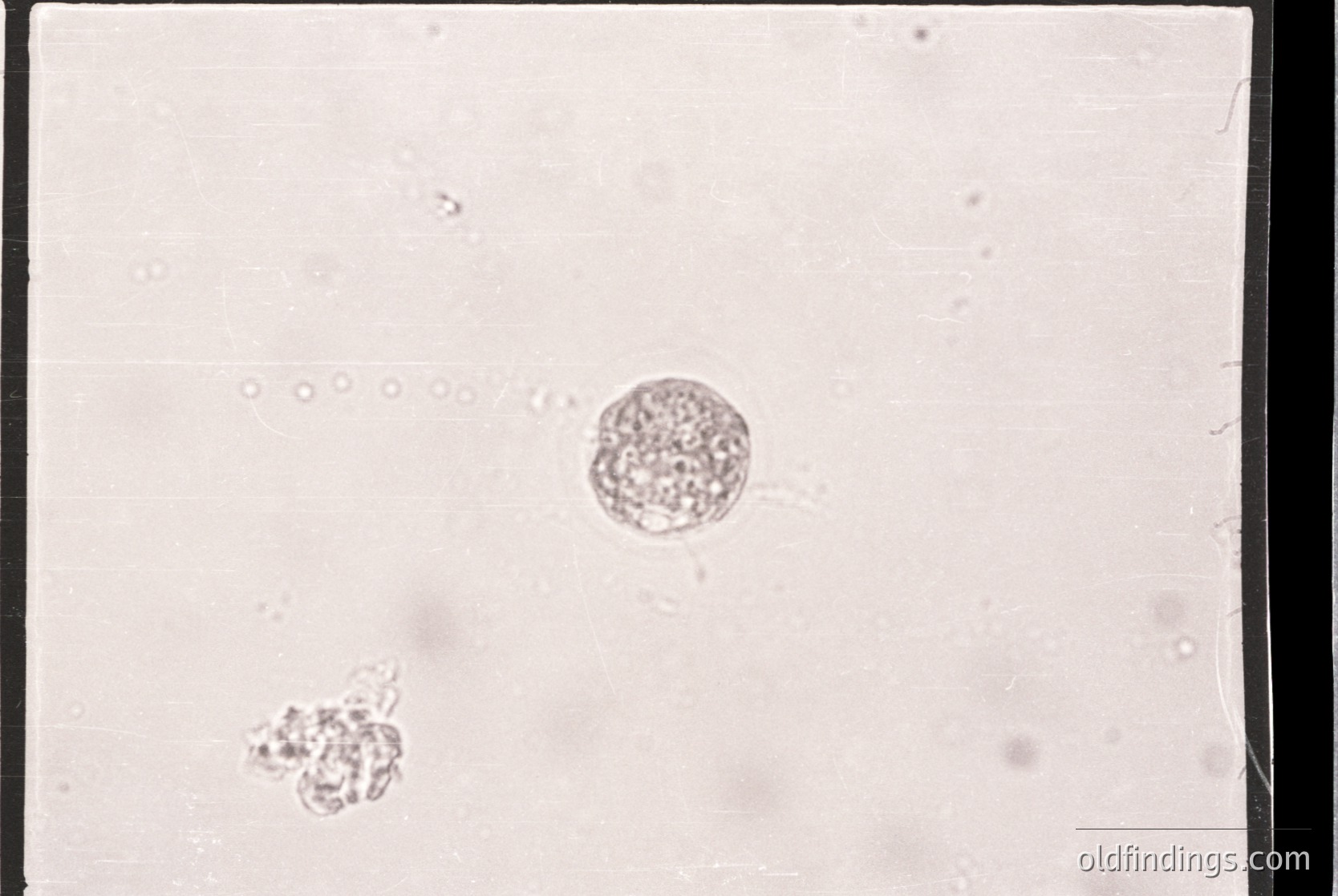 Microscopic view of a single blastocyst-stage embryo (central) with smaller cell clusters, likely from IVF or assisted reproduction. Stained slide for cellular visualization.