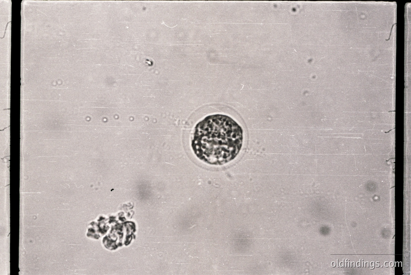 Microscopic view of clustered cells, likely bacteria or fungal spores under high magnification. Circular formation suggests possible biofilm or spore cluster. Ideal for microbiology, medical research, or scientific documentation.