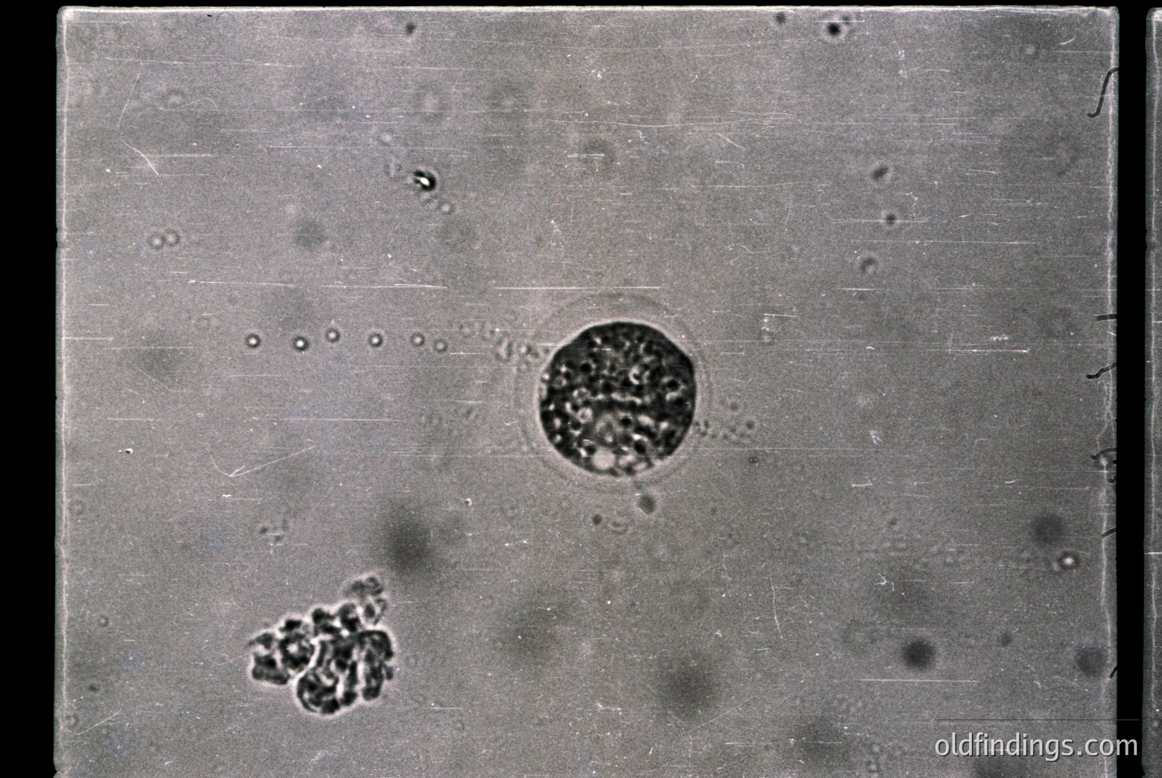 Microscopic view of cellular structures, likely bacteria or protozoa, under a high-magnification lens. The central circular formation resembles a dividing cell or colony, while the smaller cluster below suggests individual organisms or spores.