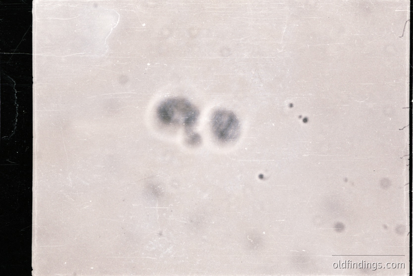 Microscopic view of two clustered cells, likely stained for contrast. Appears to be a historical medical slide, possibly from a Gram stain or similar technique. *(Note: Without clearer details or context, this remains a general description. For precise identification, consultation with a specialist is recommended.)*