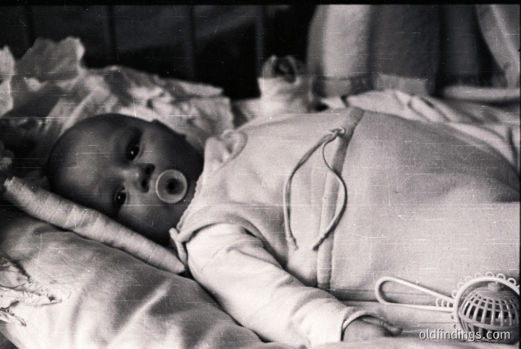 Black-and-white photo of an infant with a tracheostomy tube, lying in a hospital crib. Medical equipment like a humidifier is visible, suggesting mid-20th century clinical care ( ).
