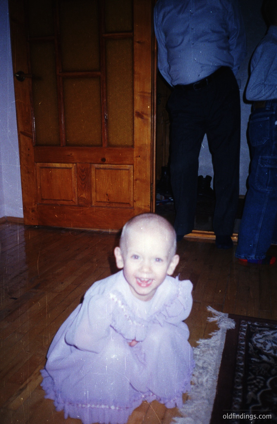A young child, likely a toddler, is pictured in a playful pose on a patterned rug. They wear a pale blue, ruffled dress and a visible birthmark. A partial view of an adult in jeans and a blue shirt is in the background. Likely a candid family snapshot, possibly 1970s.
