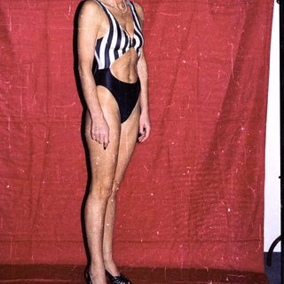 Woman in black-and-white striped swimsuit posing.