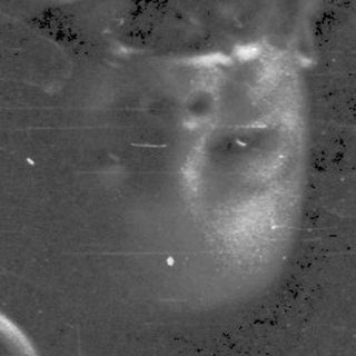 Blurry ultrasound image of a fetus.