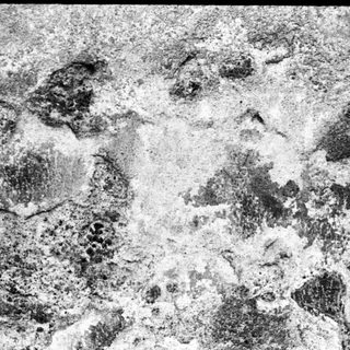 Irregular, dense bone tissue structure.