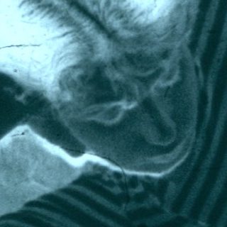 Person sitting on bed, leaning on elbow.