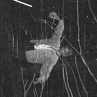 Person climbing tree with ropes.
