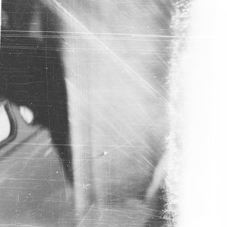 Vintage X-ray of human shoulder blade.