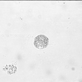 Microscopic view of yeast cells and clusters.