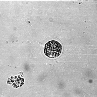 Microscopic view of sperm cells.