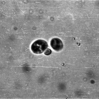 Microscopic view of two adjacent cells.