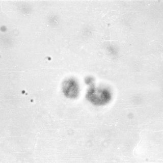 Microscopic view of clustered cells or organisms.