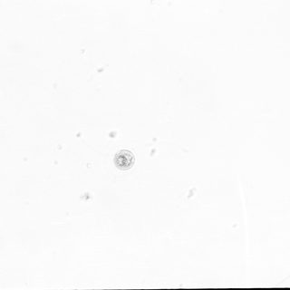 Microscopic view of a single cell.