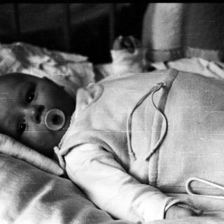 Infant with tracheostomy tube in hospital bed.