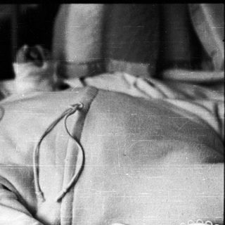 Infant with tracheostomy tube in hospital bed.