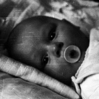 Infant with tracheostomy tube in hospital bed.