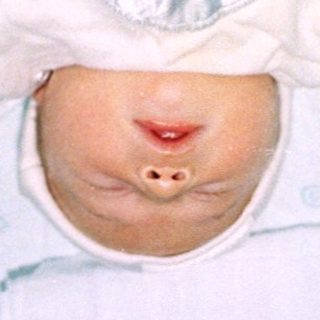 Newborn baby wrapped in a white blanket.
