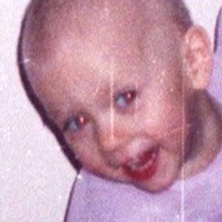 Child with a shaved head sits on a chair.