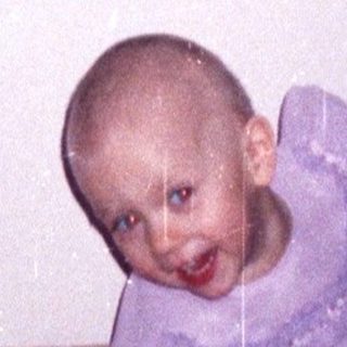 Child with a shaved head sits on a chair.