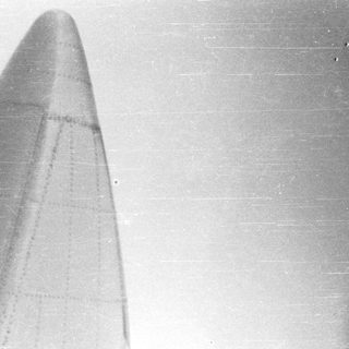 X-ray image showing a possible foreign object in the body.