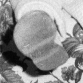 Baby reaching for something while seated in a chair.