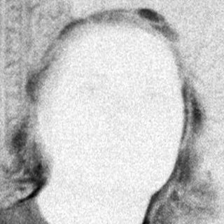 Here's a brief summary of the image: Woman seated in a chair, viewed from the knees down.