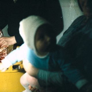Here's a brief, factual summary of the image: Person handling a bloody organ in a yellow bucket. If you need more details or