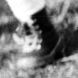 A child runs through a field wearing a coat.