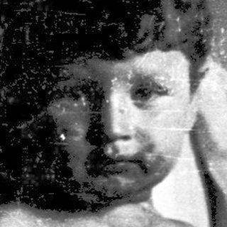 Child with severe skin lesions indoors.