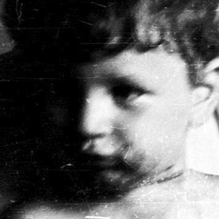 Shirtless child with visible scars indoors.