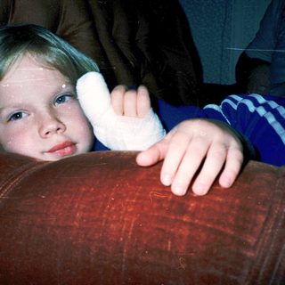 Young child with bandaged arm peeking from behind.