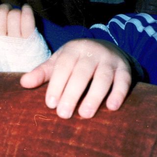 Young child with bandaged arm peeking from behind.
