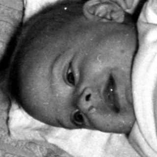 Infant lying on a striped blanket and white cloth.