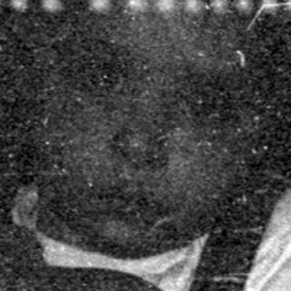 Infant in plaid trousers on patterned fabric.